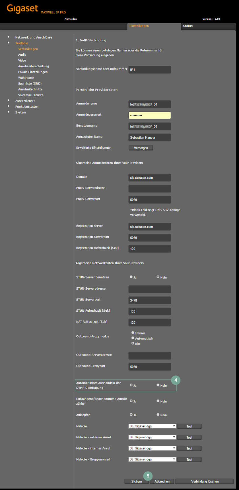 Gigaset-Oberfläche DTMF anschalten